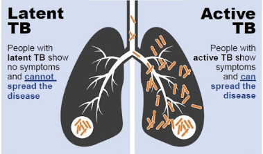 Asma Bronkitis Pneumonia PPOK dan Dampak Polusi pada Pernapasan